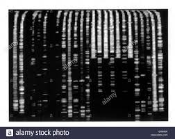 Dna Chart 1998 From The Us Armed Forces Institute Of