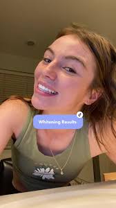 results of the whitening strips #teeth #teethwhitening #teethwhiteninghack  #results #thisiswhatitlooklike #whiteteethcheck #fypシ