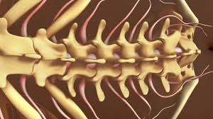 Failed Back Surgery Syndrome Radiofrequency Ablation And Adhesiolysis