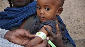 Hunderttausenden Kindern in Äthiopien droht der Hungertod