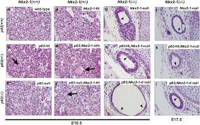Find out information about ultimobranchial. Development Of Thyroid Gland And Ultimobranchial Body Cyst Is Independent Of P63 Laboratory Investigation