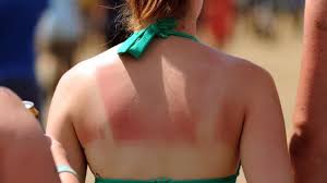 Skin cancer is actually one of the easiest cancers to find. Can One Case Of Severe Sunburn Give You Cancer Itv News
