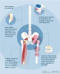There are 4953 back bones for sale on etsy, and they cost $10.93 on average. Causes Of Popping Noise In The Lower Back Cellaxys