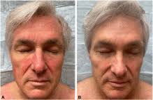 Table of Contents page: Journal of the American Academy of Dermatology