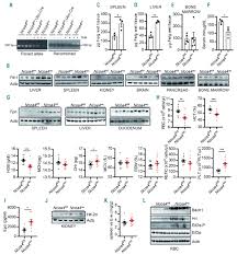 Tamoxifen is a selective estrogen receptor modulator (serm) that competitively binds to estrogen receptors on tumors and other tissue targets, producing a. Ncoa4 Maintains Murine Erythropoiesis Via Cell Autonomous And Non Autonomous Mechanisms Haematologica