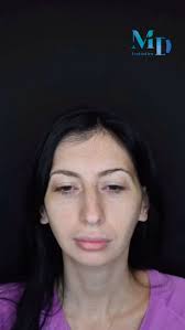 Op.Dr.Murat Diyarbakırlıoğlu