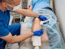 Image result for Radiofrequency Surgery