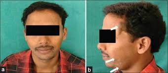 2013-3-Suppl 1 Archives