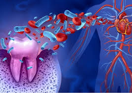 How chronic conditions are linked to oral health - Healthcare Leader