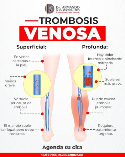 ⚠️ ¿Pesadez, dolor o enrojecimiento en las piernas? No lo ignores. La trombosis  venosa superficial y la trombosis venosa profunda pueden parecer similares,  pero no son lo mismo y ambas requieren atención