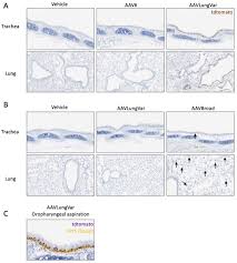 Image result for Gold 1999 AAV