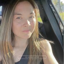 As I approached 40, dark spots and redness became some of my biggest  concerns. I started noticing them more, especially after pregnancy.  Hormonal changes, like melasma, caused dark patches to appear seemingly