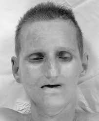 Great News: After 53 years, Jane Doe (1971) has finally been identified as  47-year-old Sarah Sharkey.