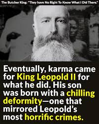 Eventually, karma came for King Leopold II. His son was born with a  chilling deformity—one that mirrored Leopold's most horrific crimes.