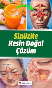 Sinuzit Belirtileri Nelerdir Neden Olur Ne Iyi Gelir Sinuzit Dogal Tedavisi Hastalik Dogal Dogal Saglik Saglik Ve Fitness