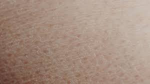 Cara mengatasi kulit kering yang ketiga adalah dengan menggunakan pelembab sehabis mandi. Mengatasi Kulit Kering Dengan Cara Mudah Di Rumah Fader Id