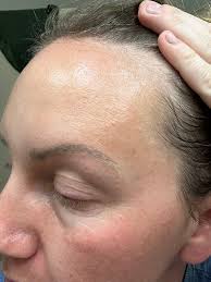 Reducing pore size for oily sensitive skin?