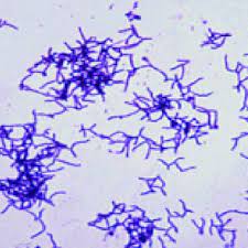 Gram Stain Of Actinomyces Naeslundii Download Scientific Diagram