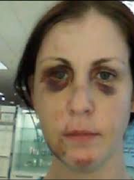 Another Woman Comes Forward about Man Charged with Beating Greenbrier Woman