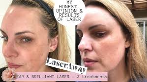 Clear and Brilliant Treatment feat. Cameron Byrnes