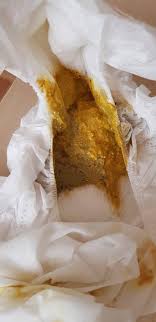 Ist der stuhlgang ihres babys in der windel grünlich, ist dies in. Stuhlgang Flaschenbaby 4lw Orange Grun Bigaia Tropfen Babyforum At