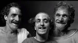 MENYEDIHKAN! Kisah Hubungan Badan Sedarah, 1 Keluarga Cacat Fisik dan  Mental, Wajah Memprihatinkan