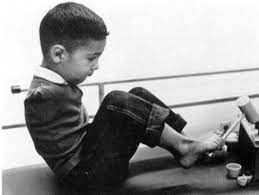 Thalidomide was introduced in 1956 and was aggressively marketed by the german pharmaceutical company chemie grünenthal under the trade name contergan as a medication for anxiety, trouble sleeping, tension, and morning. Missbildungen Wieso Contergan So Verheerend Wirkte Der Spiegel