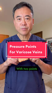 Pressure Points for Varicose Veins Relief