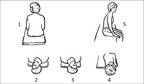 These movements bring the crystals back to the utricle, where they belong. Schematic Drawing Of The Epley Liberation Maneuver In A Patient With Download Scientific Diagram
