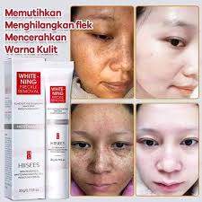 STL,RTTL,GMN,TIMOR POST,JORNAL INDEPEMDENT