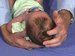 Physical Exam Newborn Normal Head Shape And Sutures Youtube