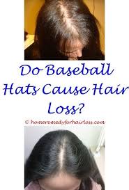 Thyroid Medicine Hair Loss Alopecia Hair Loss In Dogs Symptoms Does Graves Disease Cause Hair Loss Burning Scalp Ha Hair Loss Hair Loss Shampoo Dog Hair Loss