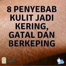 Pada trimester 3 atau akhir masa kehamilan, ibu biasanya akan merasa kulitnya gatal dan kering terutama di daerah perut dan payudara.ini karena kulit anda meregang saat kehamilan semakin membesar, moms. Apa Sebab Kulit Jadi Kering Olive House Headquarters Hq ÙÙŠØ³Ø¨ÙˆÙƒ