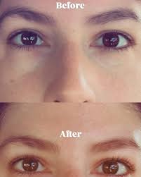 Little lift of the lashes! 👯‍♀️🩷