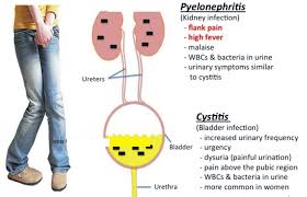 Pin On Nursing Stuff