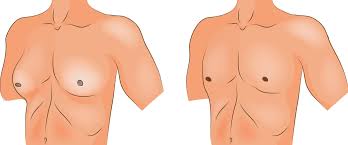 But some men might have some of the following: Gynecomastia Healthdirect