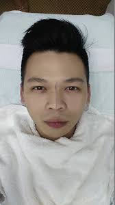 Nose Filler Injection by Esme Clinic