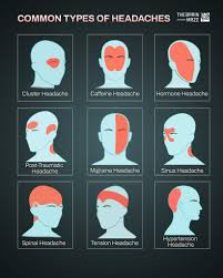 Image result for Headache