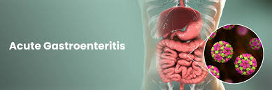 Know About Acute Gastroenteritis:Causes and Preventative Measures