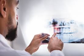 The condition is caused by abnormal bone remodeling in the middle ear. My Tooth Hurts Do I Need A Root Canal Infection Symptoms Ironhorse Family Cosmetic Dentistry Louisburg Ks