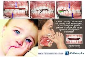 Pin Em I M A Dentist