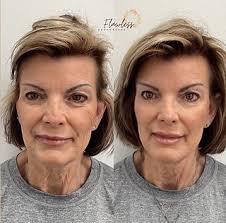 Chattanooga Licensed Esthetician Tonya Waller