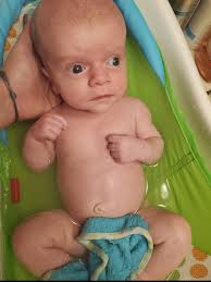 Hi all! Thought I'd share an update about my son! He was born with Spina  Bifida and Hydrocephalus and the doctors and specialists all said he'd have  no function below the waist.