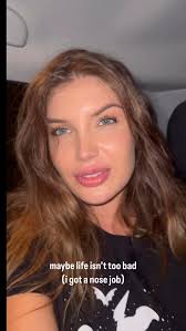 Grazie Chirurgo 🙏🏻🤣 #rinoplastica #nasorifatto #nosejob #turkey #turchia  #rinoplasticaturchia #result #rhinoplasty #rhinoplastyresults #rinoplastika  #rhinoplastie #rhinoplastik #nosejobbeforeandafter ...