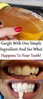 Simple Ingredient Teeth Health Health