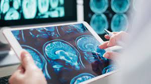5,700+ Brain Stroke Stock Videos and Royalty-Free Footage - iStock | Brain  stroke icon, Brain stroke illustration, Brain stroke concept