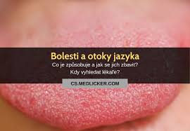 Image result for Puchýře na jazyku