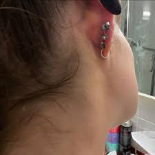 to a 0 gauge now. Septum