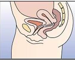 Nuvaring Drug Medicine Information