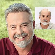 I pay 789 dollars a month and still mostly don't get the service i signed up for. Before And After Image Of Older Man With Hair Loss Hair Restoration Hair Growth Formula Hair Loss